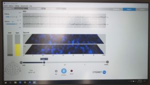 san diego neurofeedback