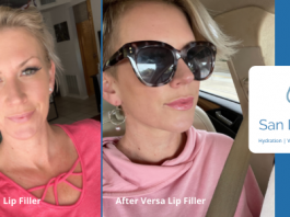 San Diego IV, San Diego Moms Trusted & Approved {Sponsored} before and after San Diego iv