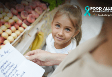food allergies