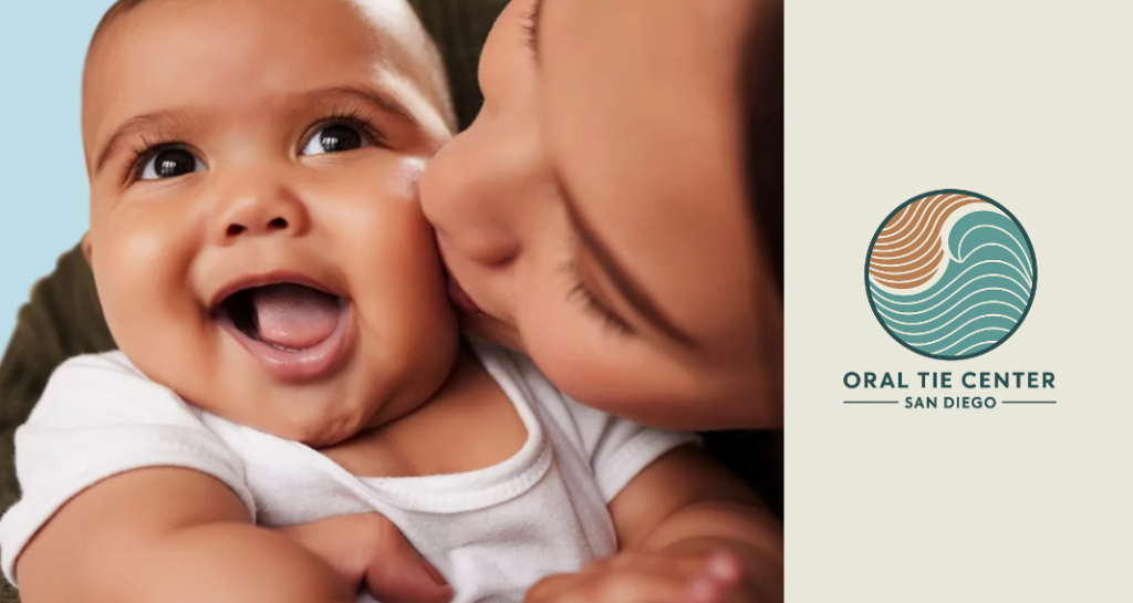 oral tie center